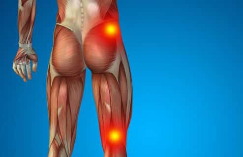 Living With Sciatica Pain? - Expert Physio Plus